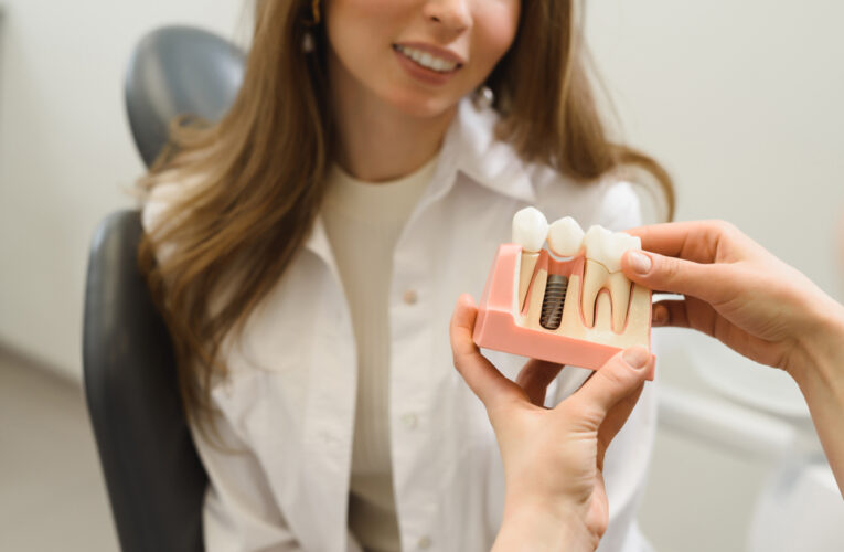Implanty zębowe: jakie są przeciwwskazania?