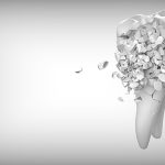 tooth-g218c3f86a_640