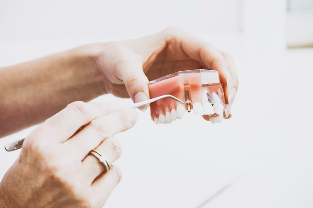Wpływ profesjonalnego wybielania zębów na zdrowie jamy ustnej